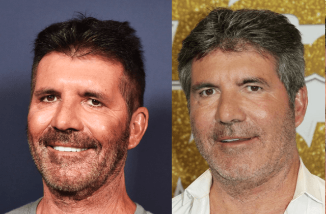 'AGT' Fans Shook: Is Simon Cowell's New Face Due To Vegan Diet Or Botox?