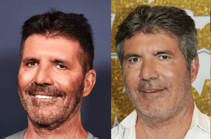 Simon Cowell before after. Can it just be a vegan diet or it is Botox? 