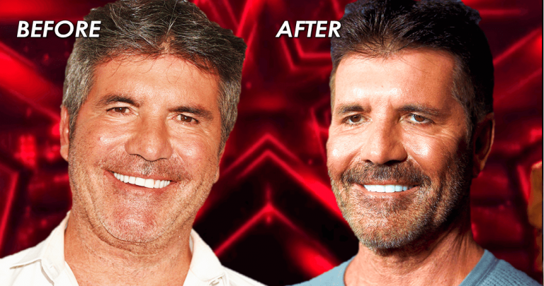 'AGT' Fans Shook: Is Simon Cowell's New Face Due To Vegan Diet Or Botox?