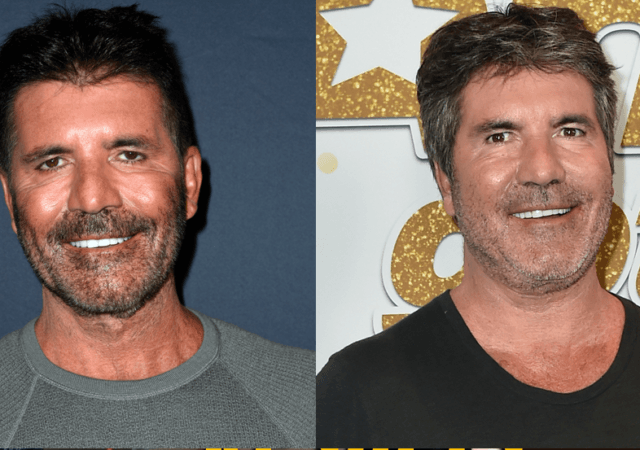 'AGT' Fans Shocked: What The Heck Happened To Simon Cowell's Face? Here ...