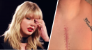 Taylor Swift Gets Emotional On ‘The Voice’ Over Shocking Heart Surgery Story