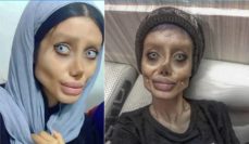 Angelina Jolie Look-alike Zombie Girl Is Sick With COVID In Iranian Prison — Who Is Fatemeh Khishvand?